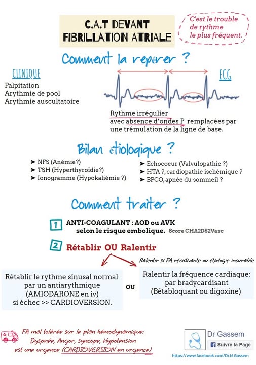 Fibrillation atriale